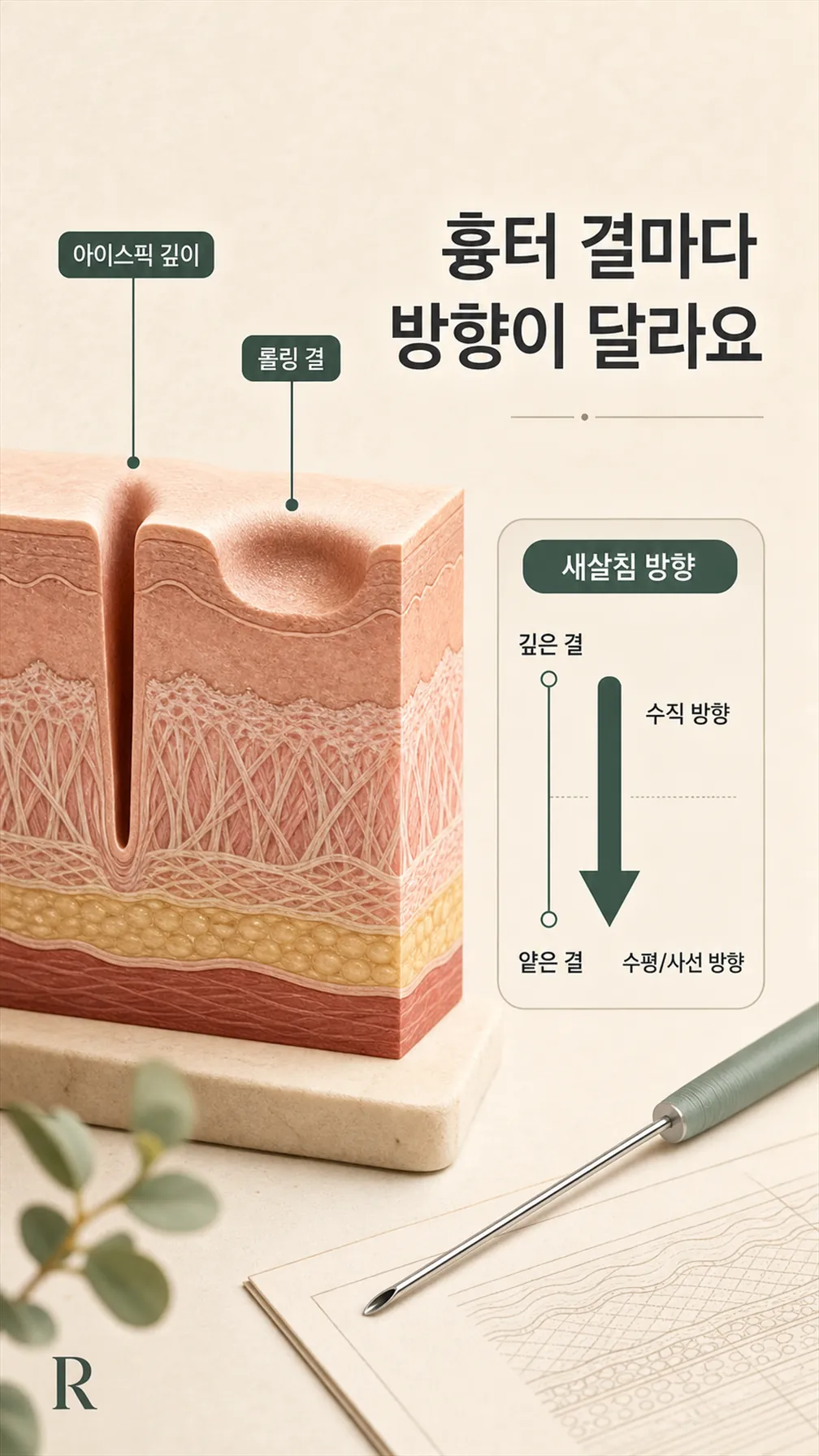 아이스픽 vs 롤링 진피 단면 비교