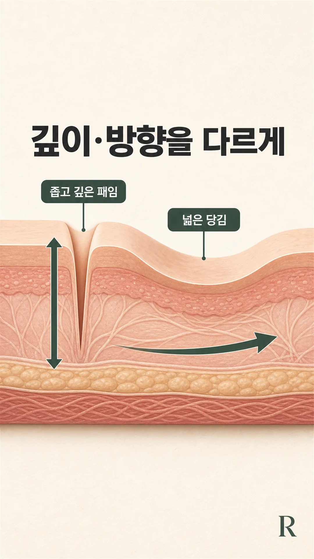 혼합형 단면 — 깊이·바닥이 섞인 구조