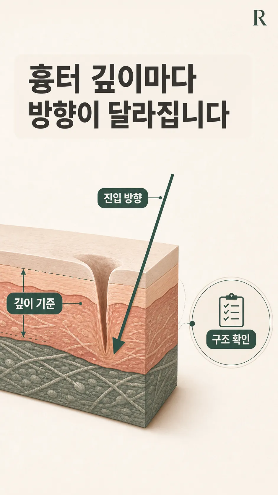 단면 자가 체크 기록 노트