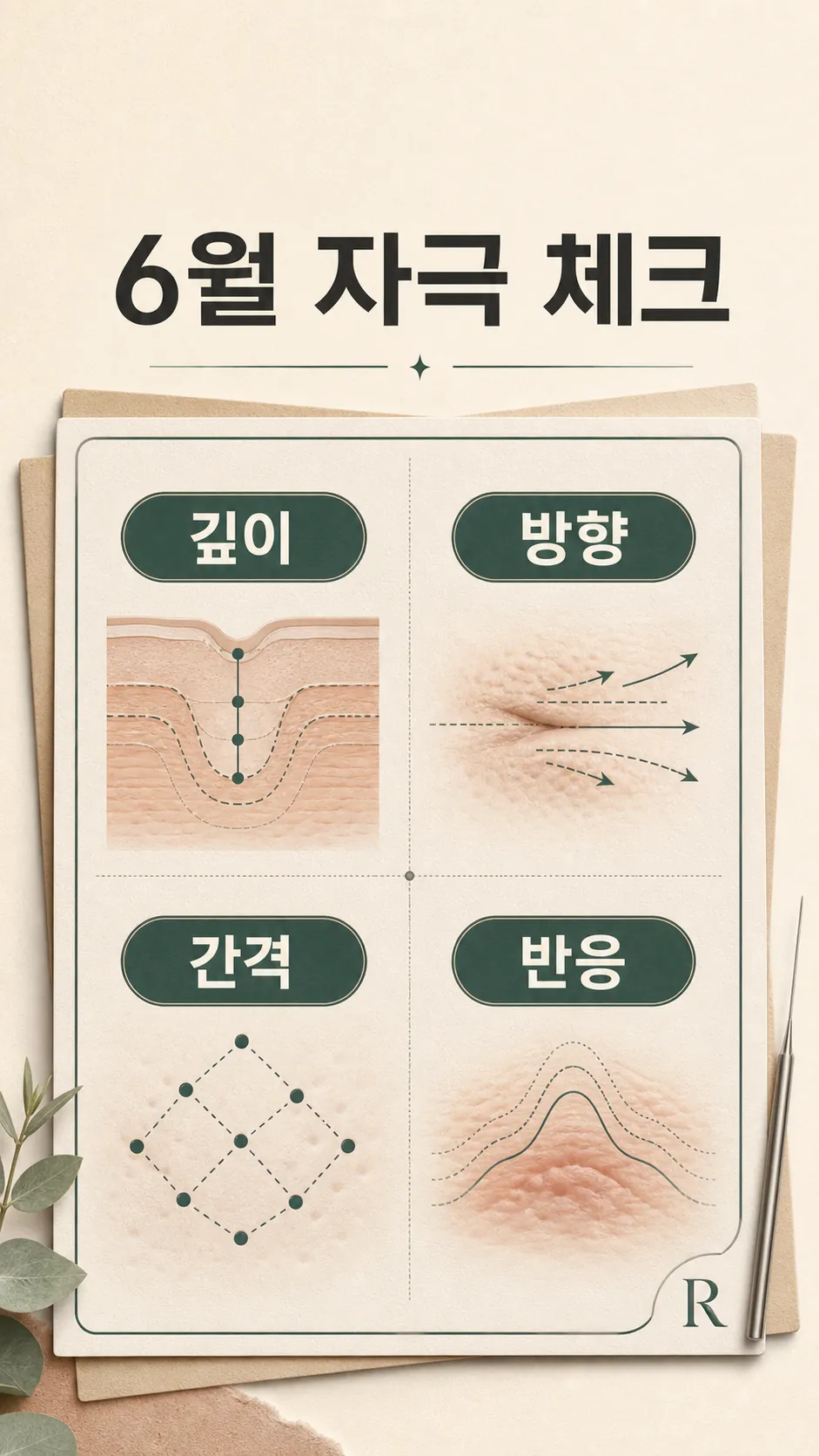 색의 문제와 패임 비교 도식 카드