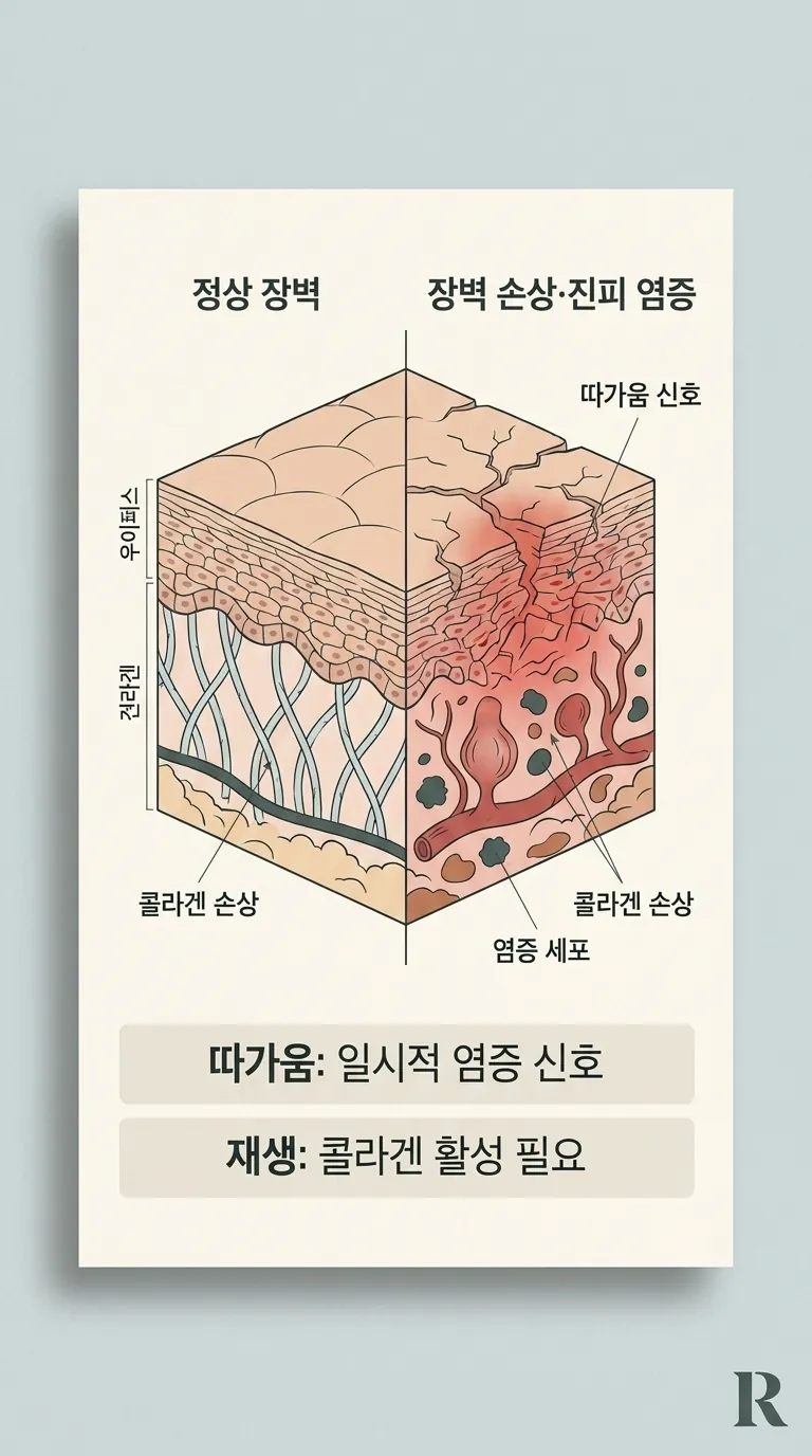 피부 장벽 손상과 진피 염증 단면 모식도
