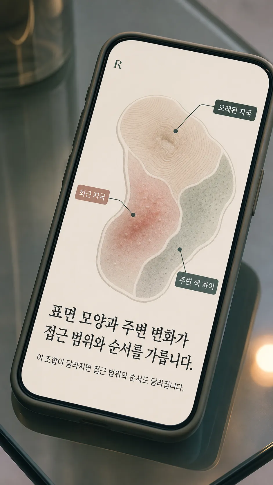 자국 위로 최근의 붉은기 경과 정리 노트