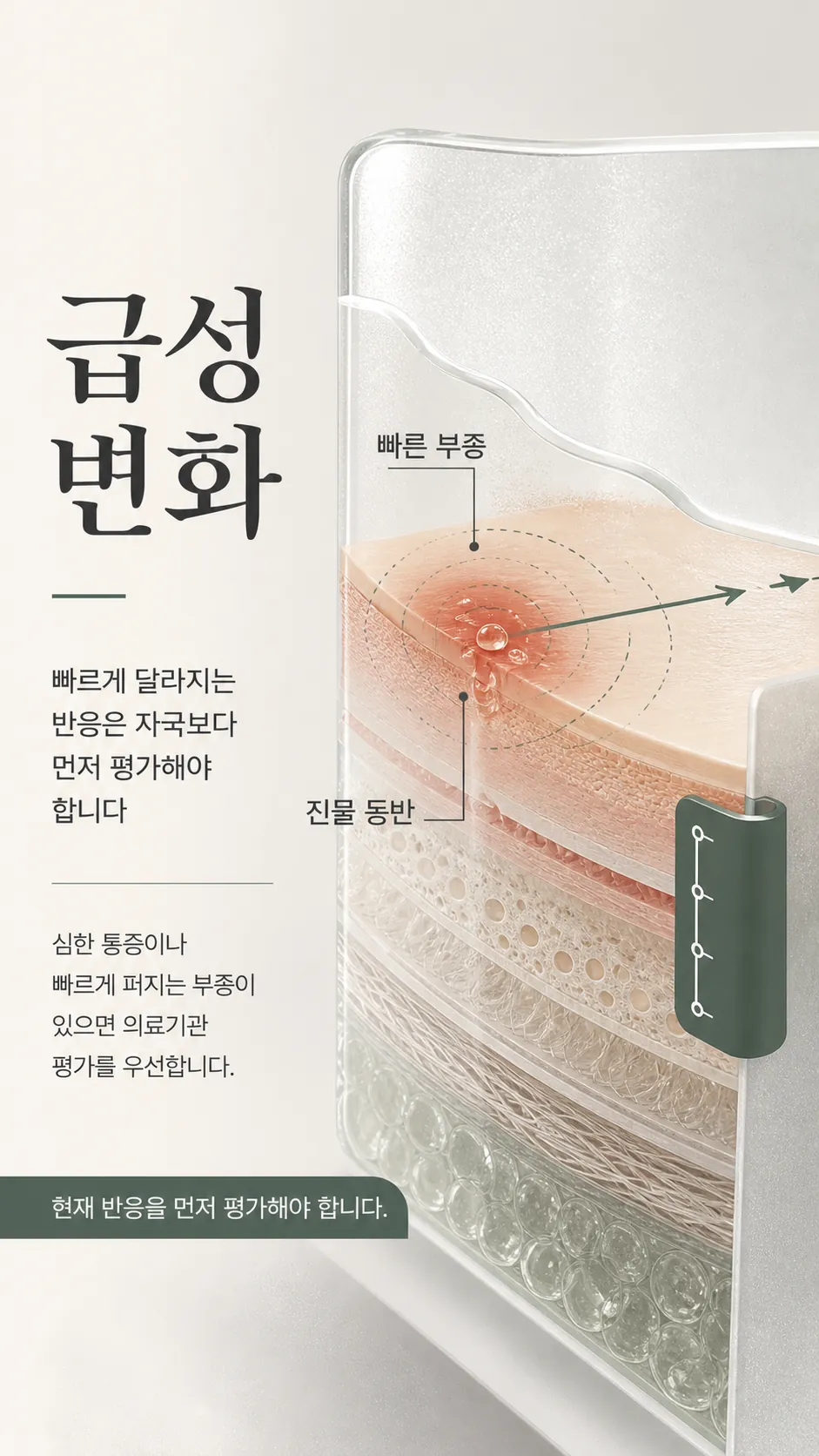 빠르게 번지는 부종 경과 정리 노트