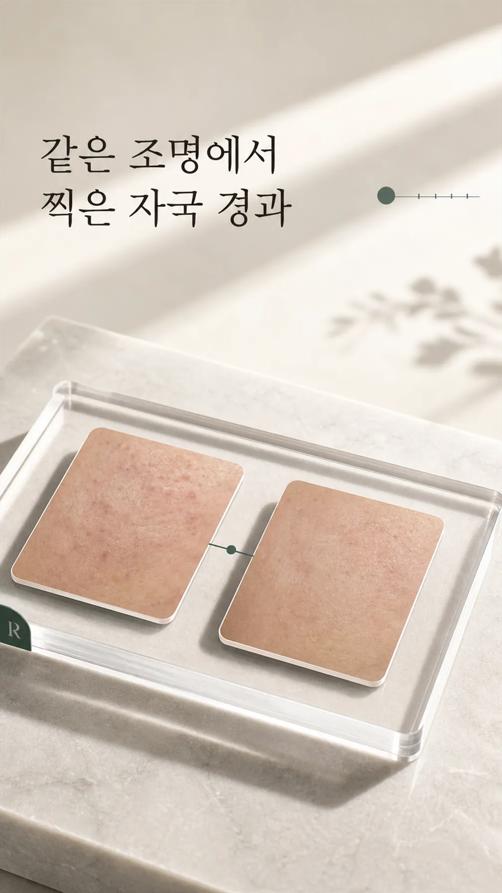 같은 조명에서 찍은 자국 경과 비교 기록 노트