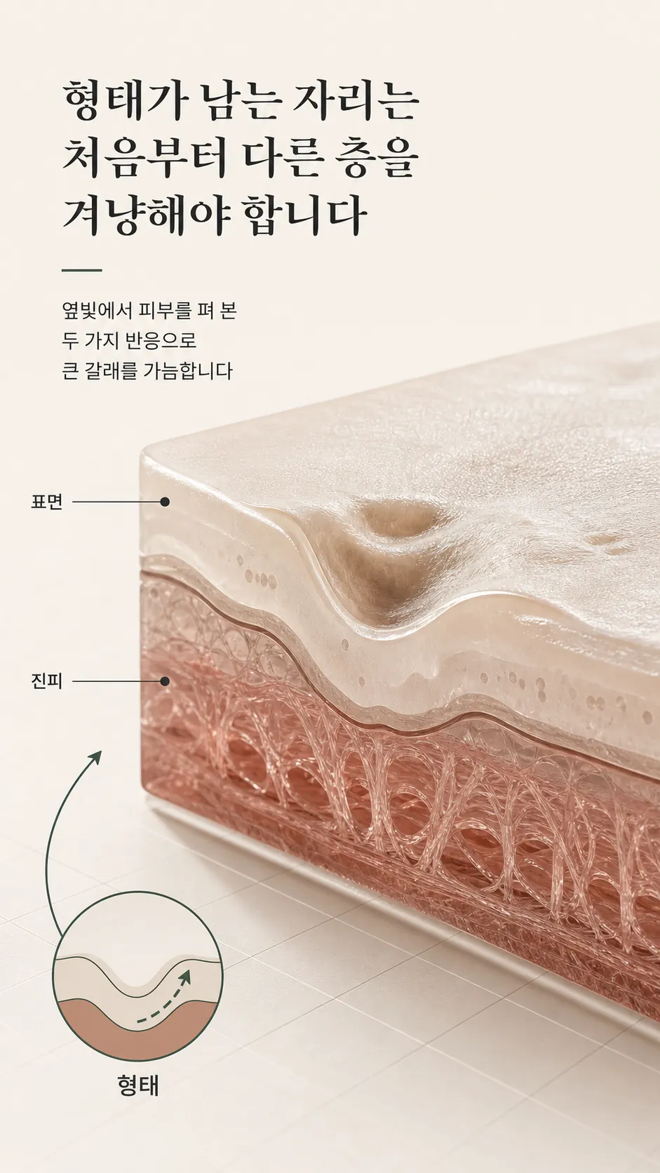 진피층 흉터 깊이와 회복 방향 단면 모식도