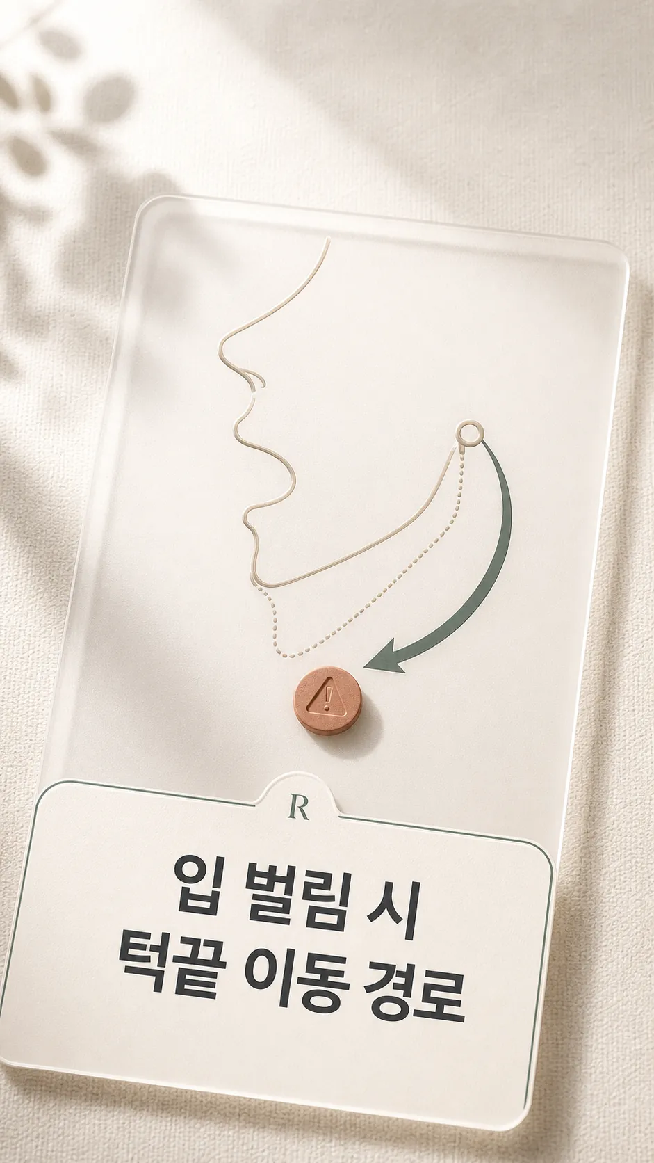 입 벌림 시 턱끝 이동 경로 화살표 도식