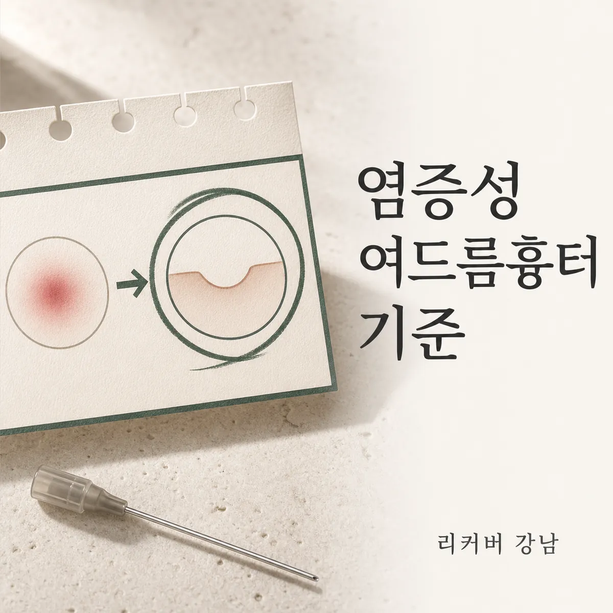 썸네일 - 남성 염증성 여드름흉터, 비슷한 고민과 어디서 갈리나요