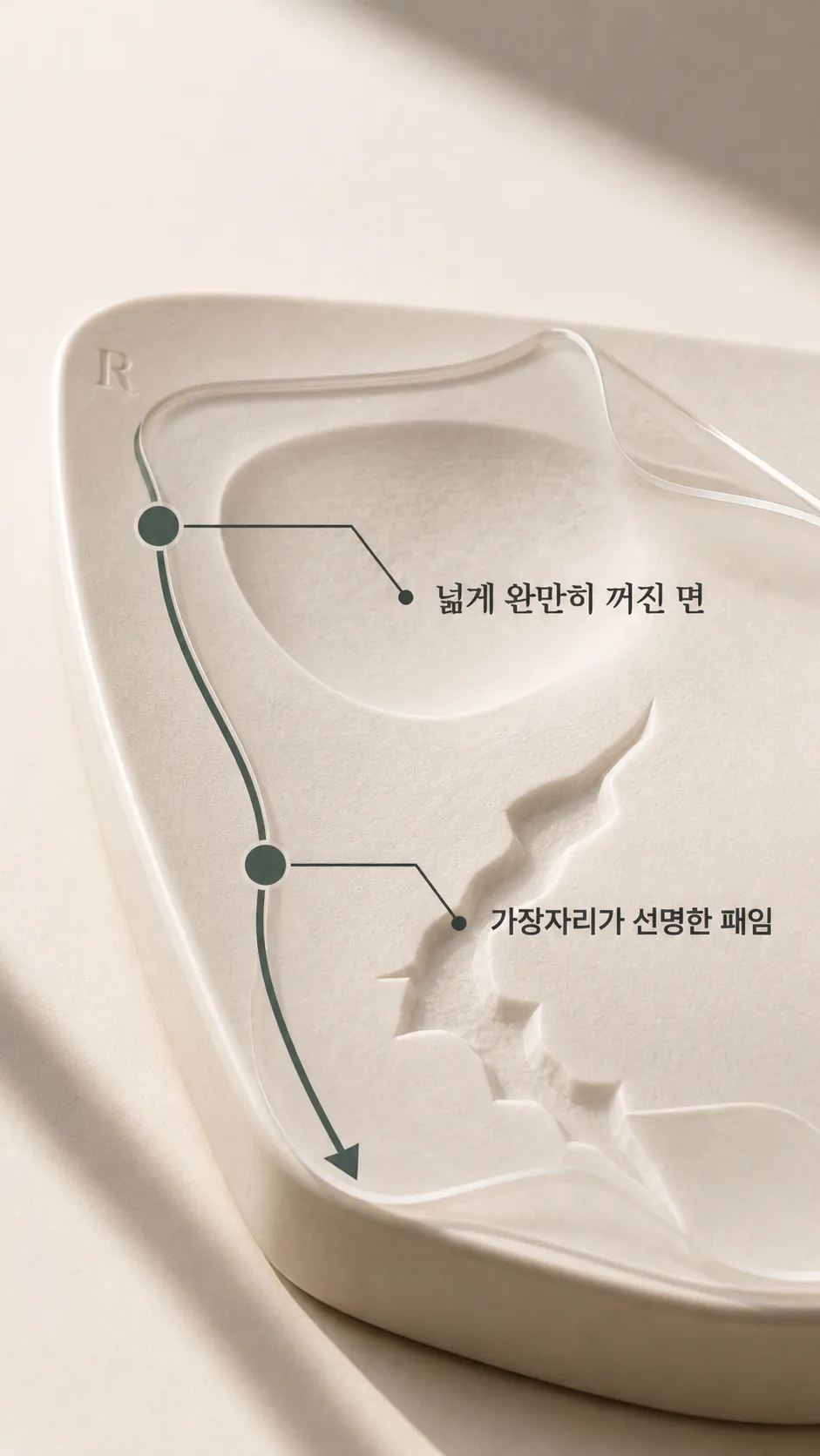 한 부위 안에서 깊이가 저마다 다르게 남은 자리를 나눠 본 표면 지도