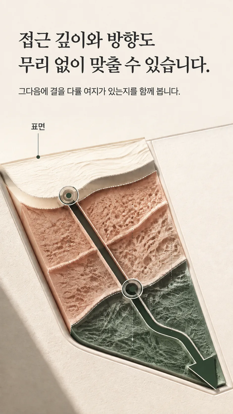 서브시전 흉터 깊이와 회복 방향을 층으로 나눠 표시한 깊이 지도