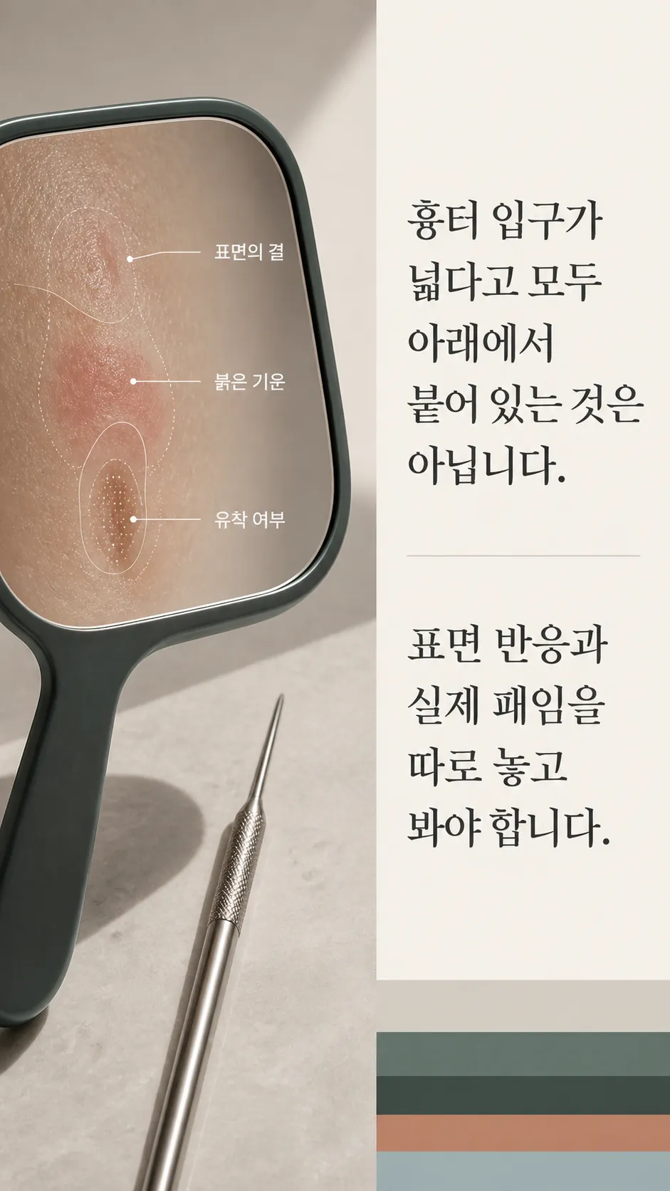 선정릉 흉터 전 깊이·시점·회복 기준 3라벨 요약