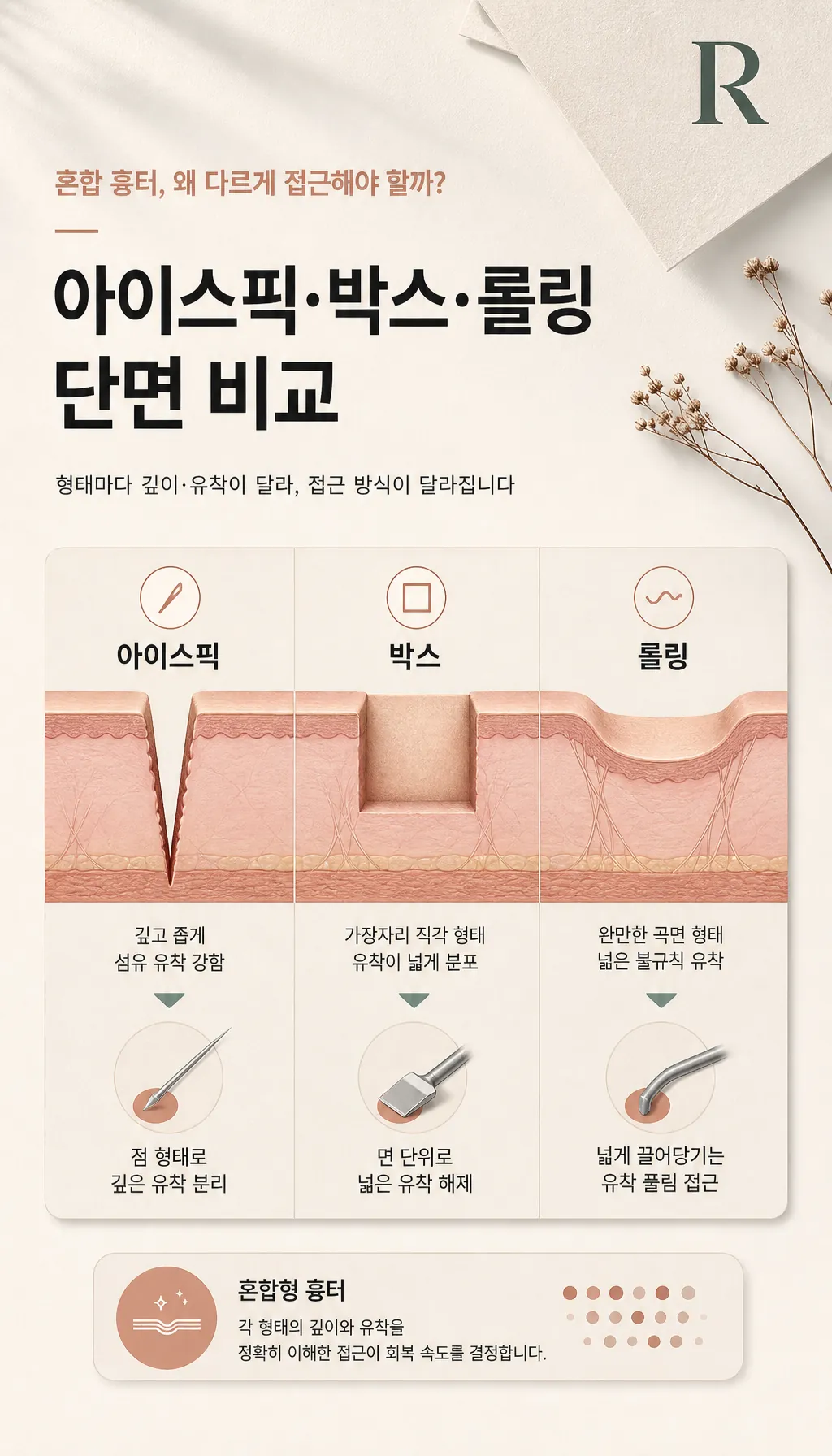 아이스픽·박스·롤링 단면 비교 도식
