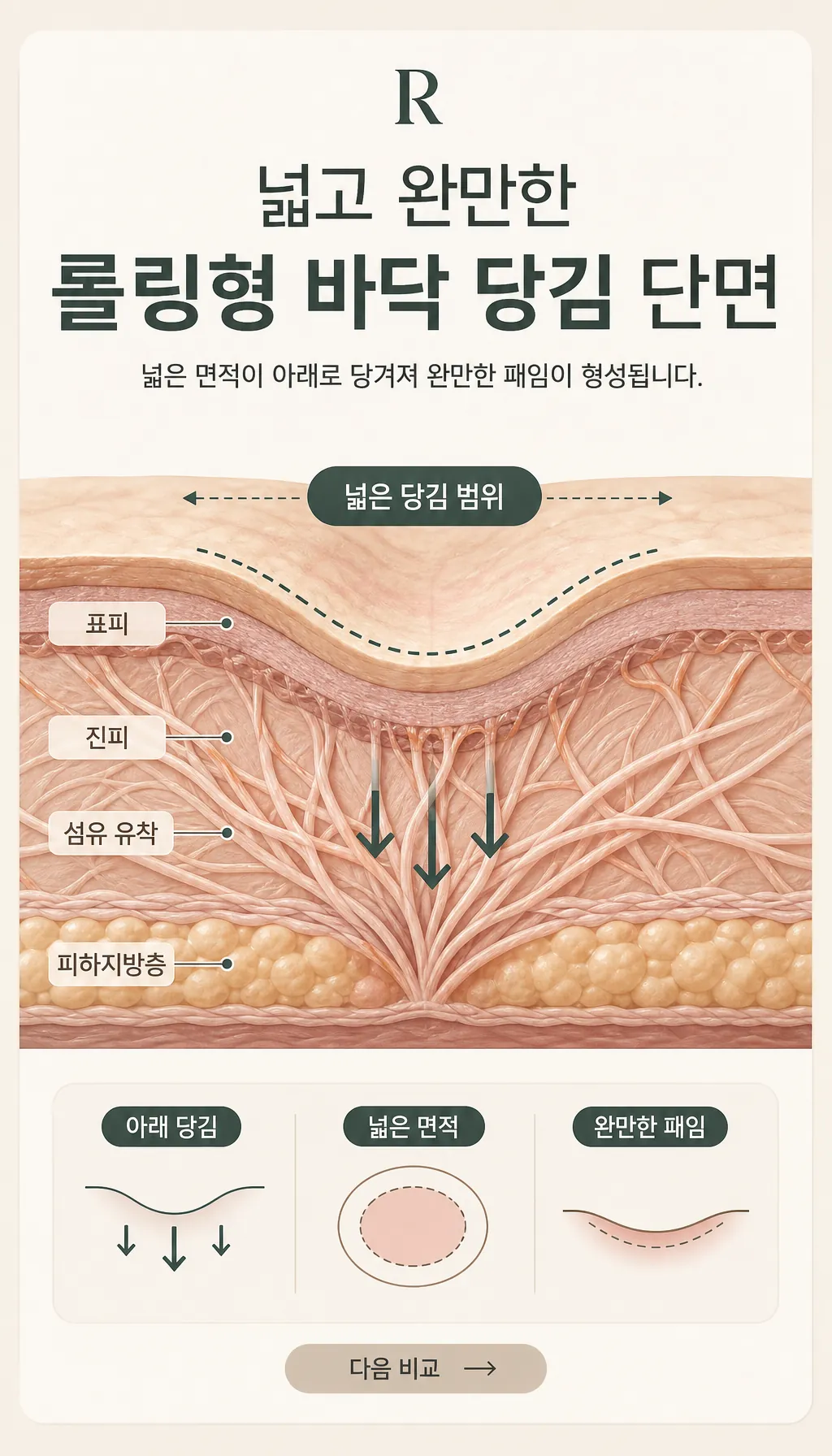 넓고 완만한 롤링형 바닥 당김 단면