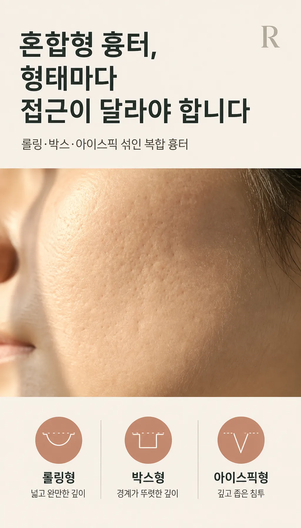 비스듬한 빛에 드러난 피부 표면 요철 클로즈업