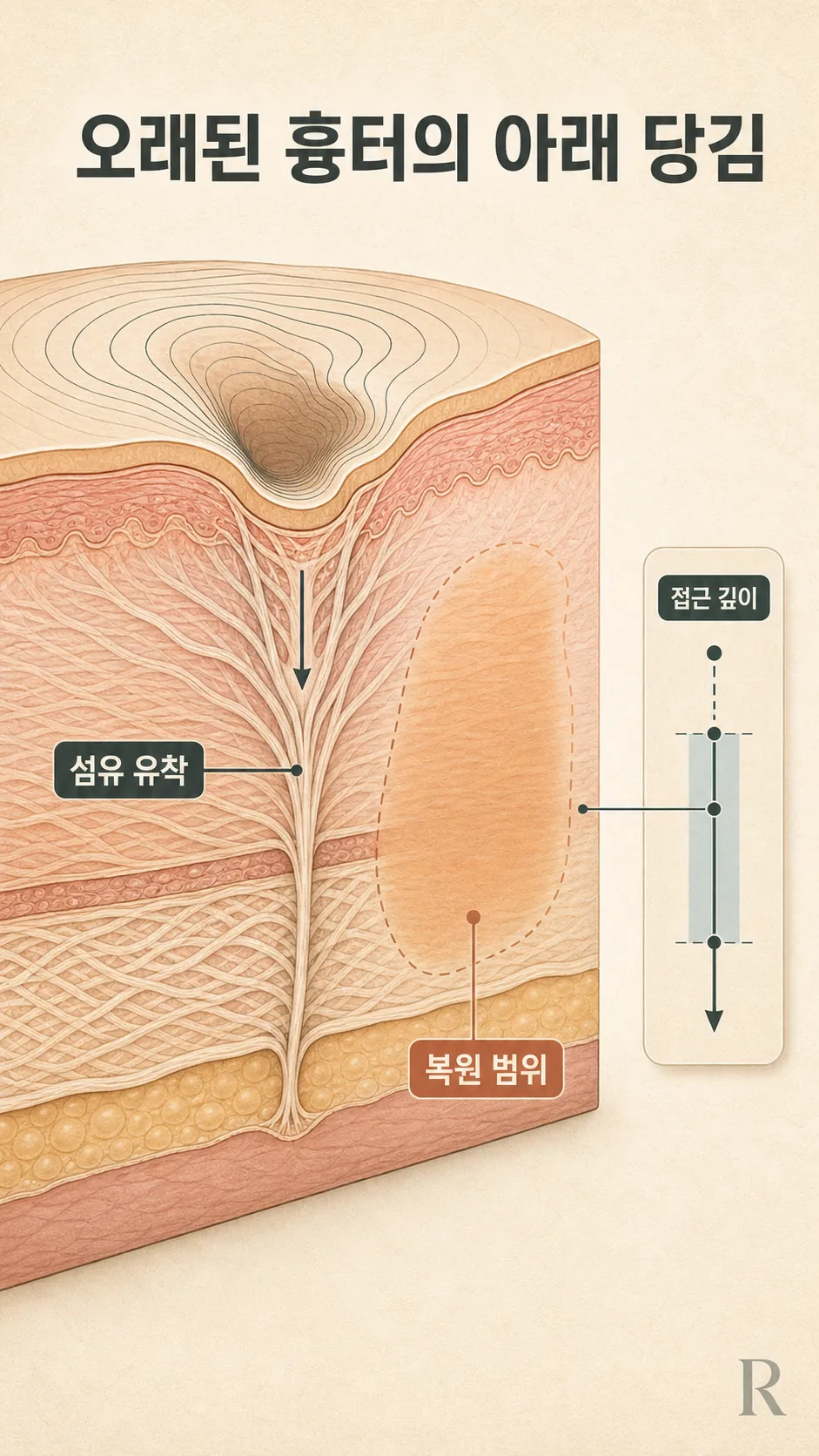 흉터 관리 5단계 생활 루틴 노트