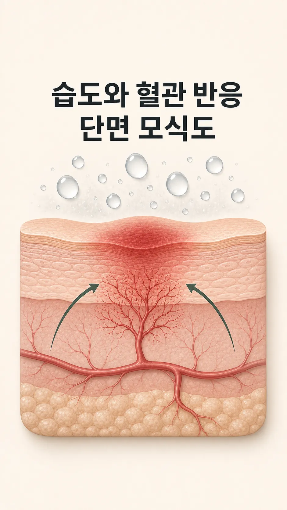 습도와 혈관 반응 단면 모식도