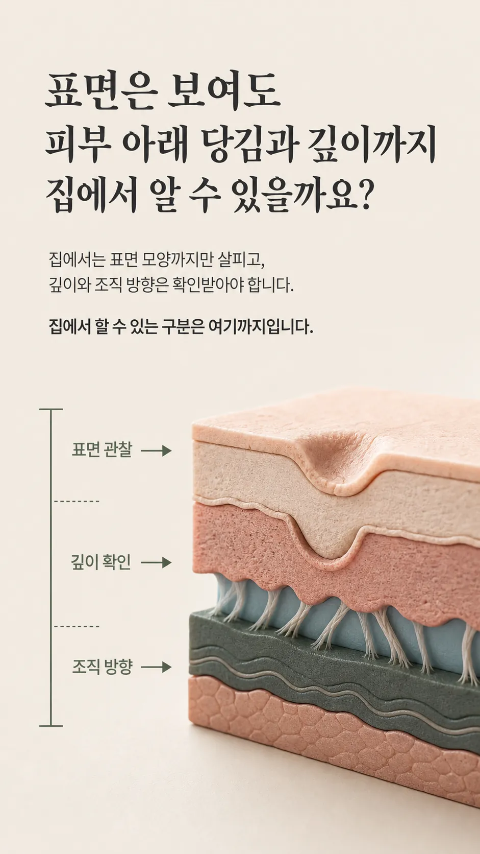 진피층 콜라겐 유착과 피부층 단면 모식도