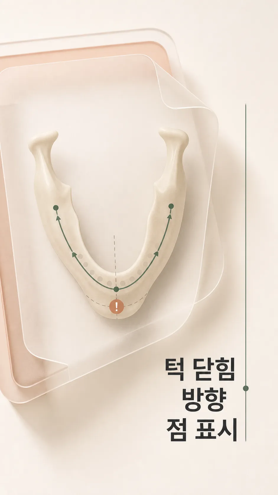 턱 닫힘 방향 점 표시