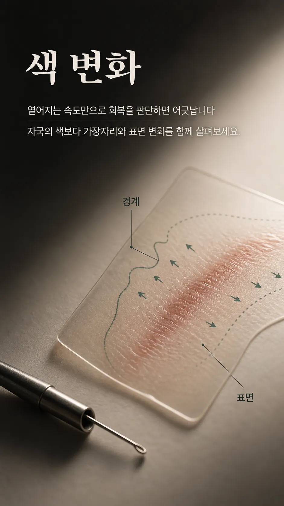 자국의 가장자리 확인 기준 메모