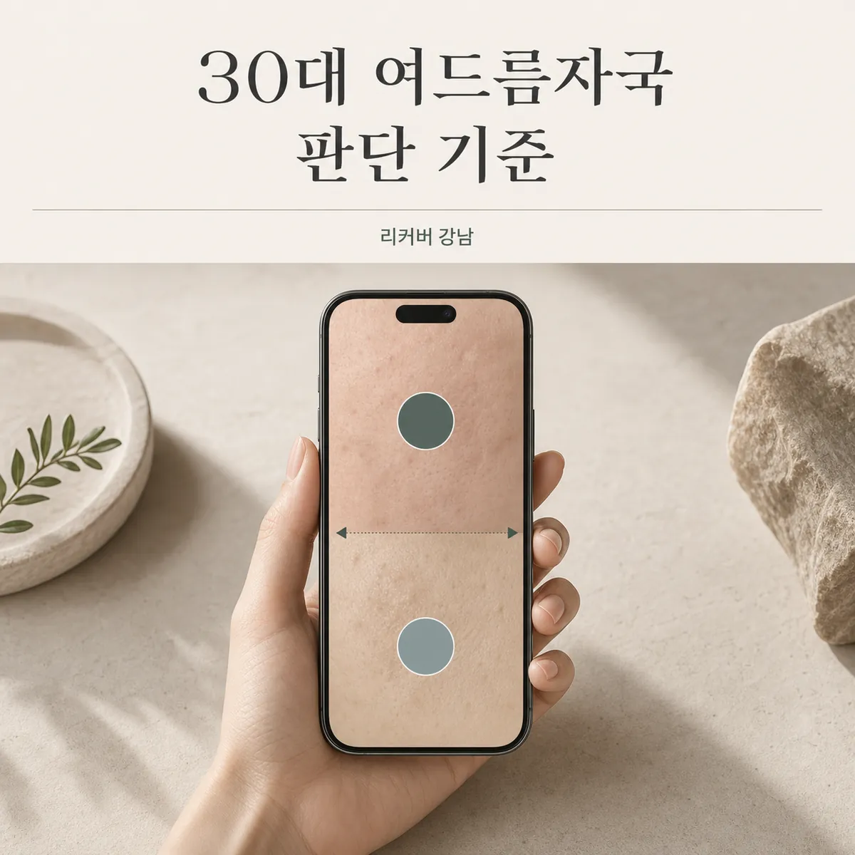 썸네일 - 30대 여드름자국, 생활 자극과 함께 살펴볼 기준