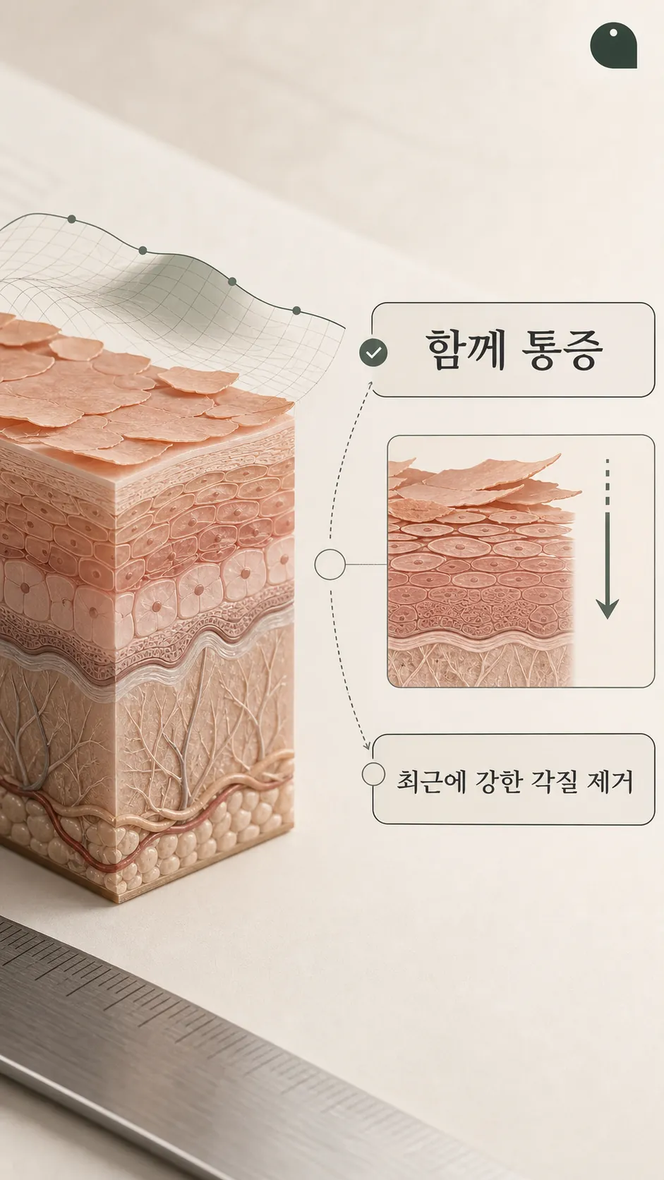 진피층 콜라겐 유착과 피부층 단면 모식도