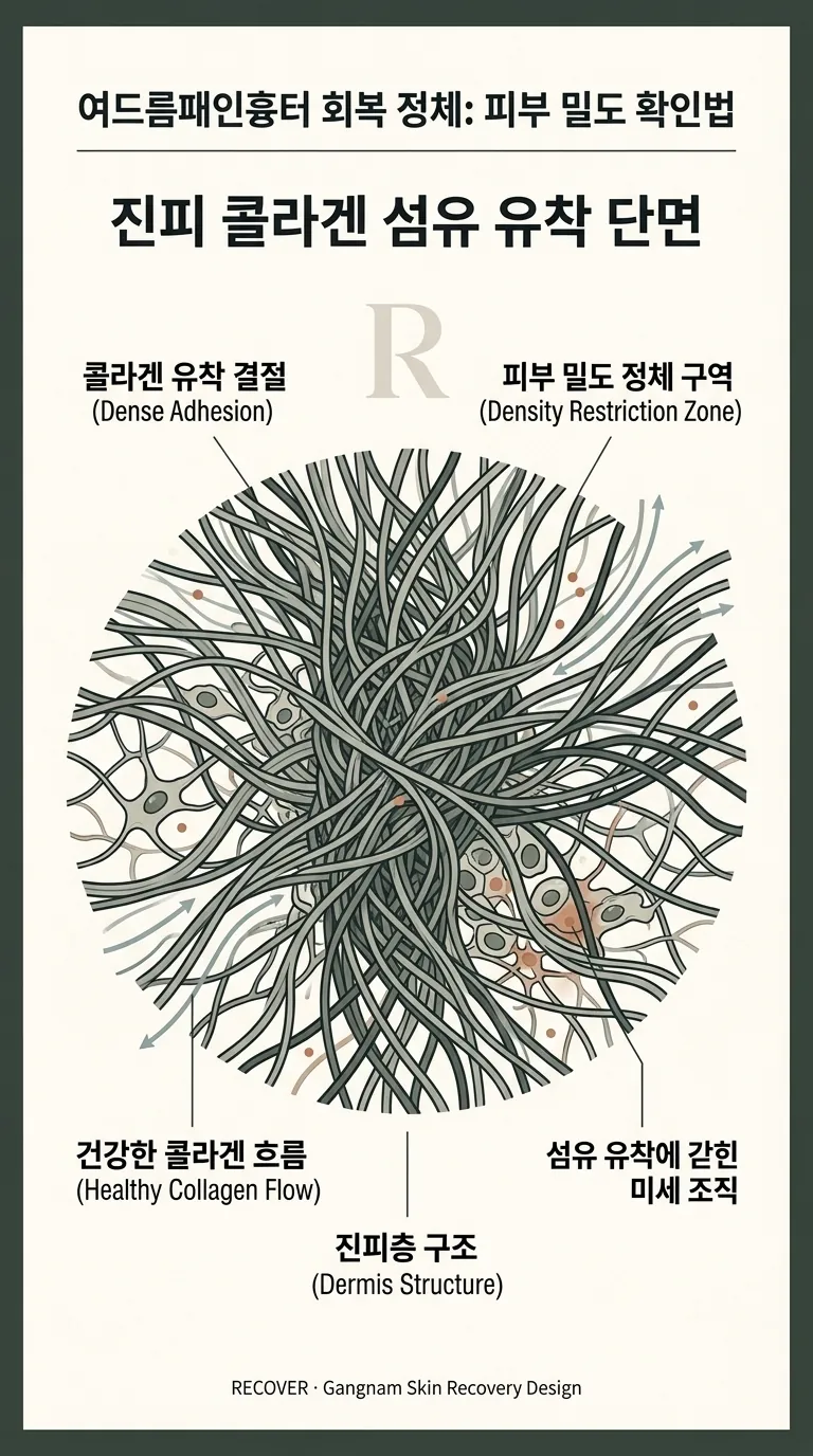 진피 콜라겐 섬유 유착 단면