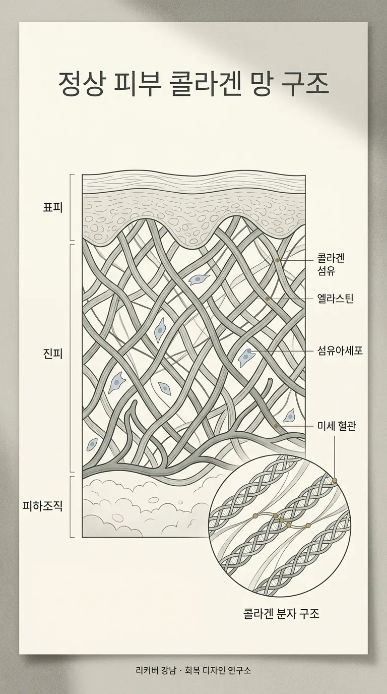 진피 단면 — 정상 콜라겐 망 구조
