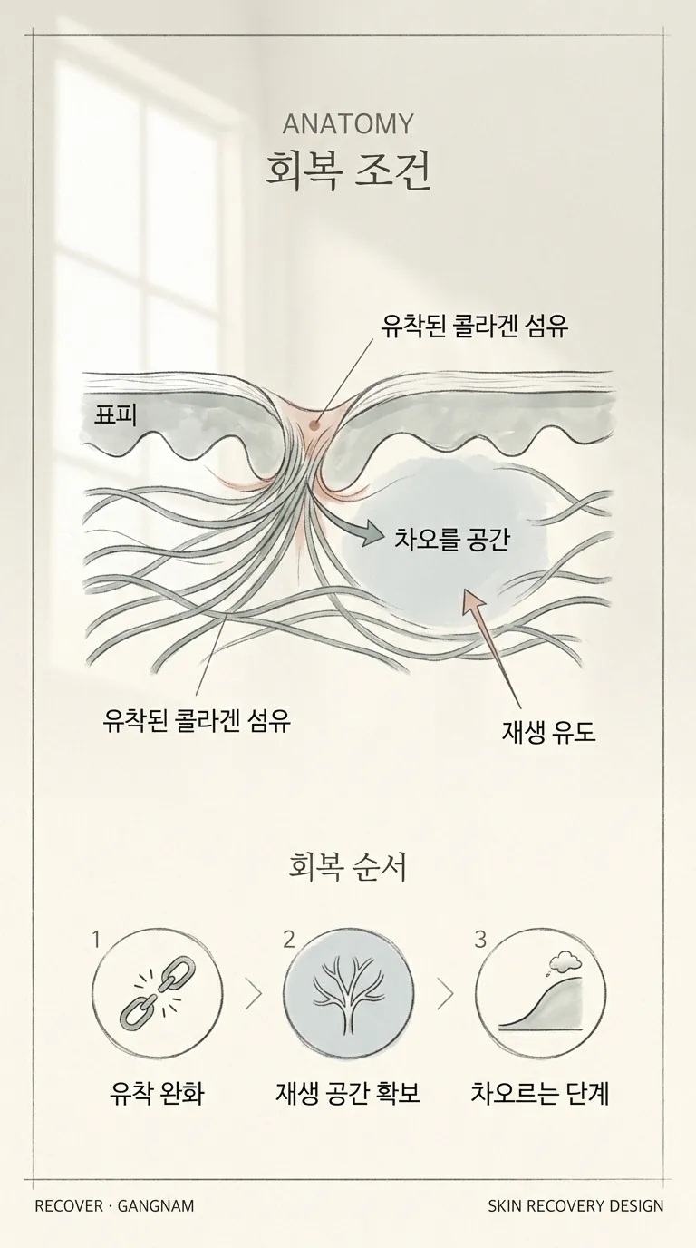 진피 콜라겐 섬유 유착 단면 모식도