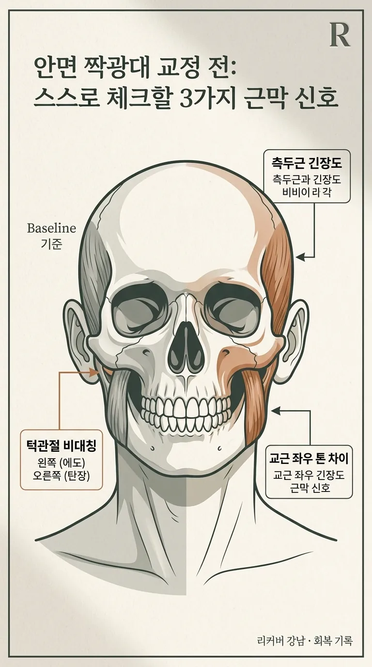 턱관절(TMJ) 주변 교근과 측두근의 좌우 톤 차이 시각화