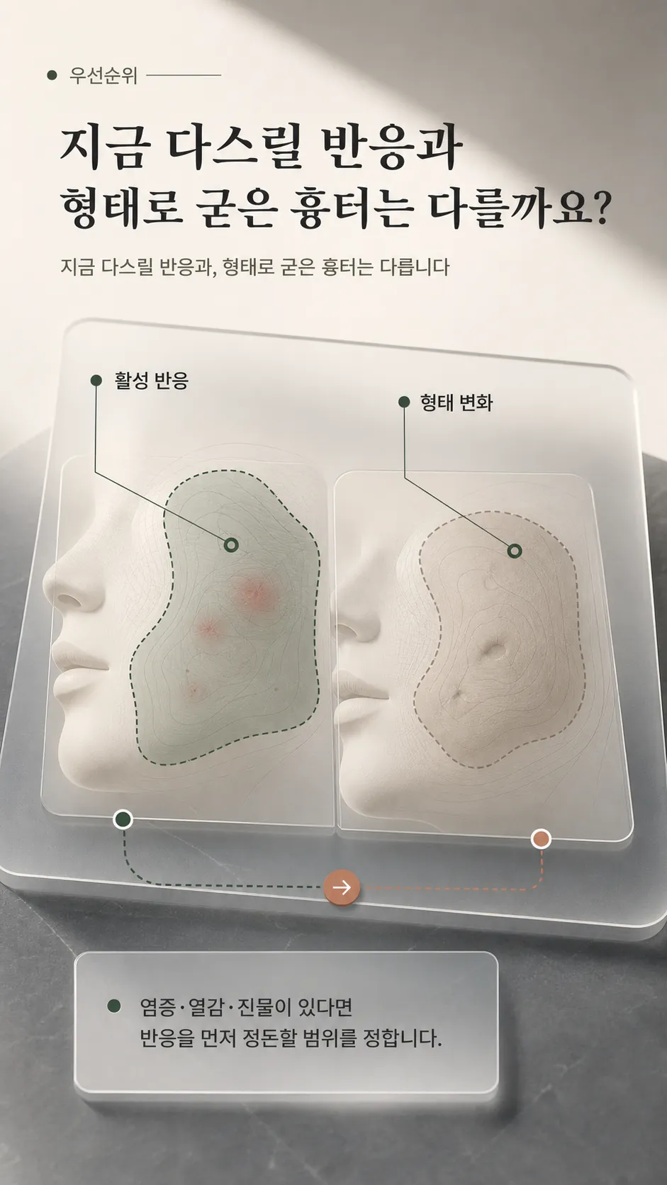 활성 염증 반응과 형태로 굳은 함몰을 두 축으로 나눠 표시한 볼 구역 도식