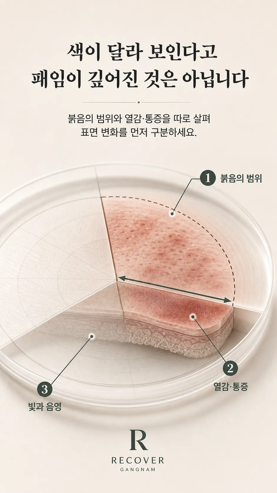 피부 표면의 색 범위와 음영 표시