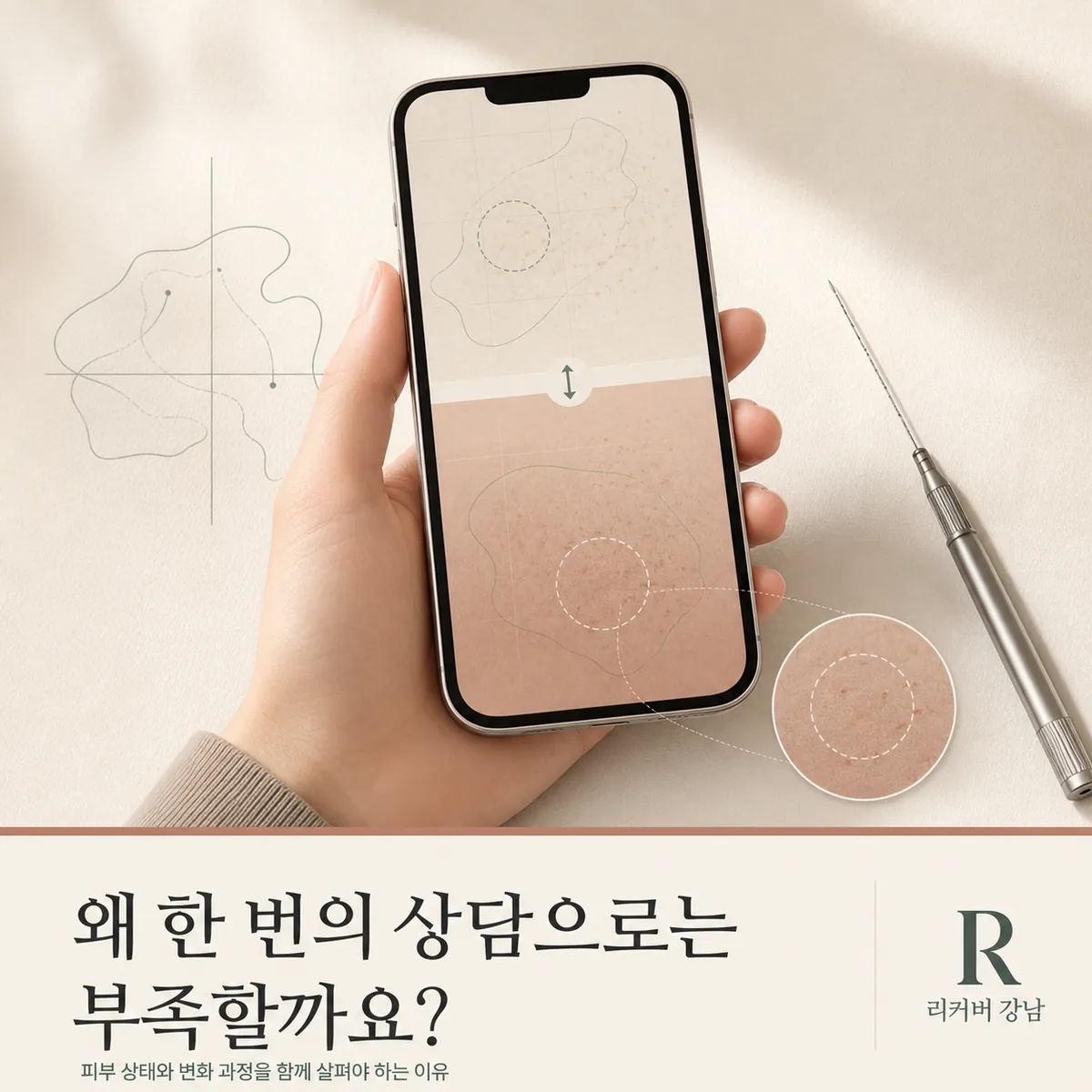 썸네일 - 강남 남성 새살침, 한 차례 상담만으로 끝나지 않는 까닭
