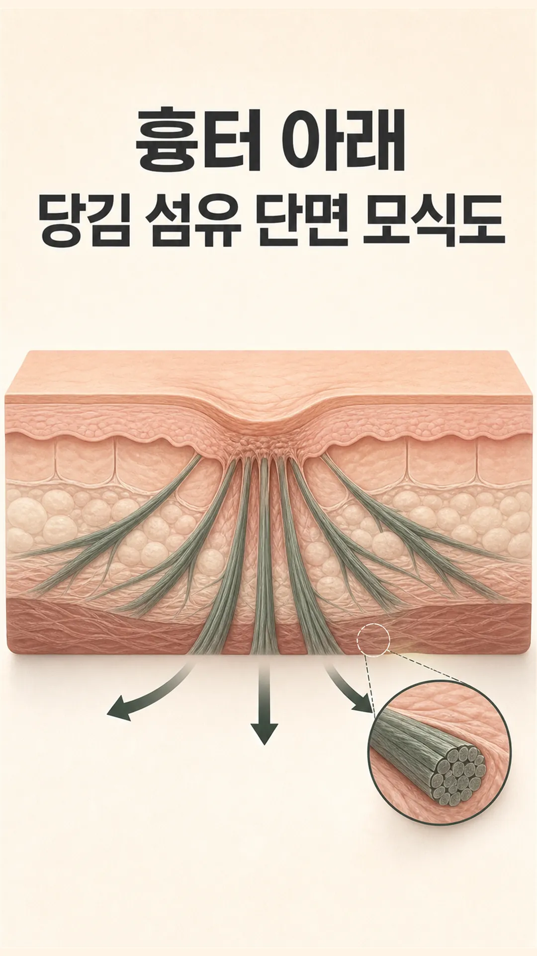 흉터 아래 당김 섬유 단면 모식도