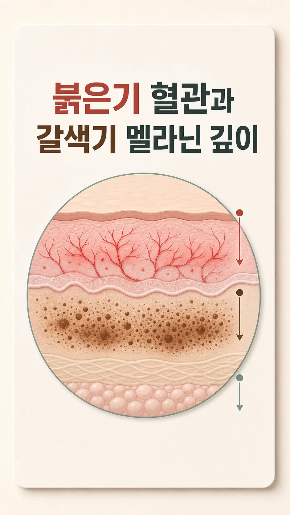붉은기 혈관과 갈색기 멜라닌 깊이 단면 모식도