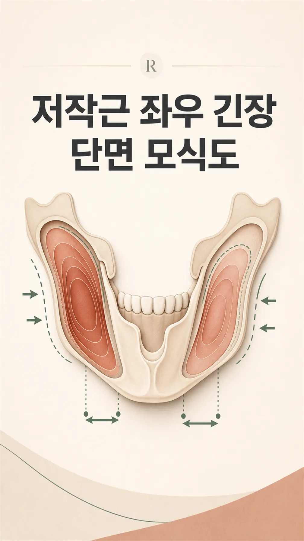 저작근 좌우 긴장 단면 모식도