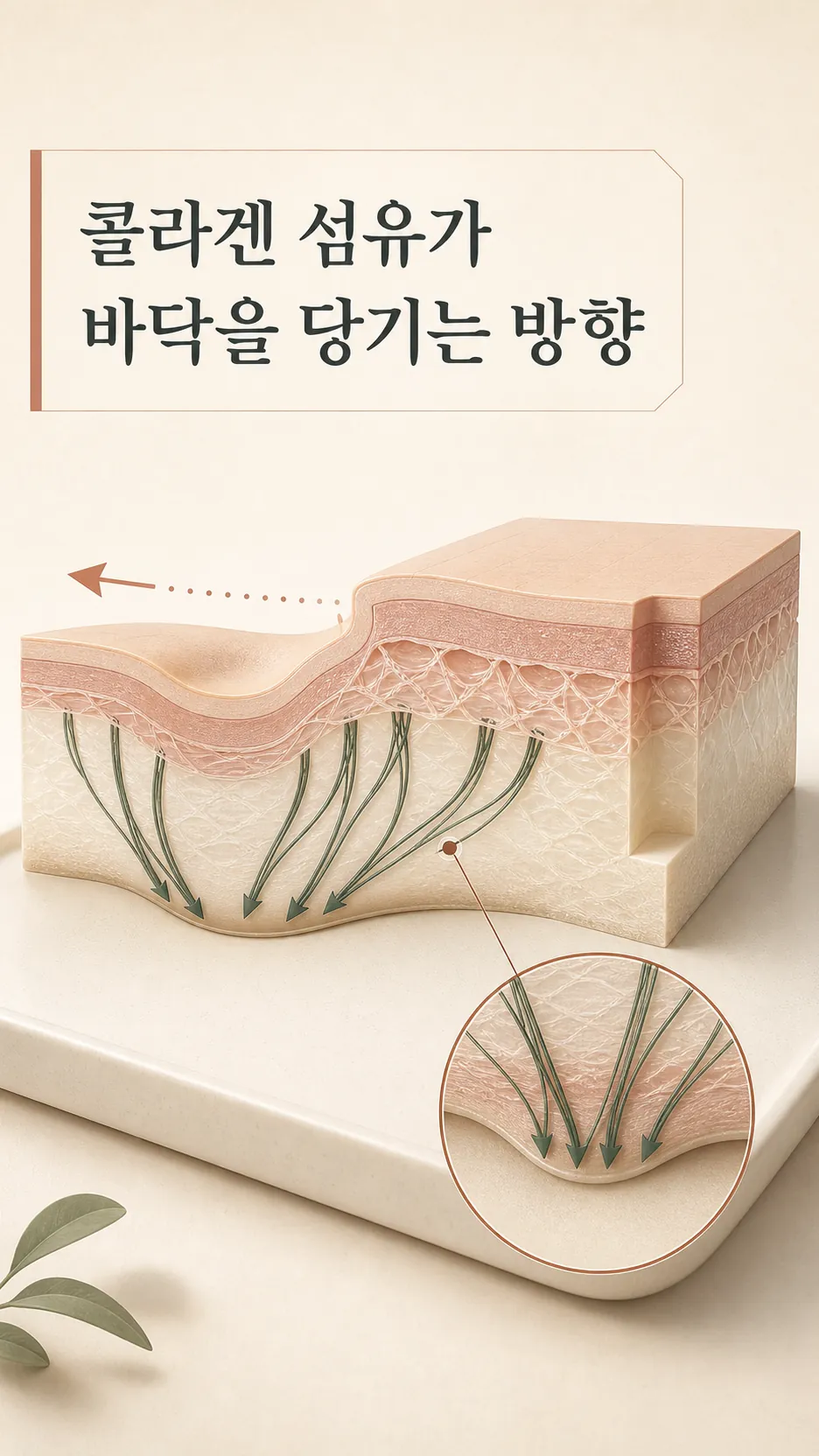 콜라겐 섬유가 바닥을 당기는 방향 모식도
