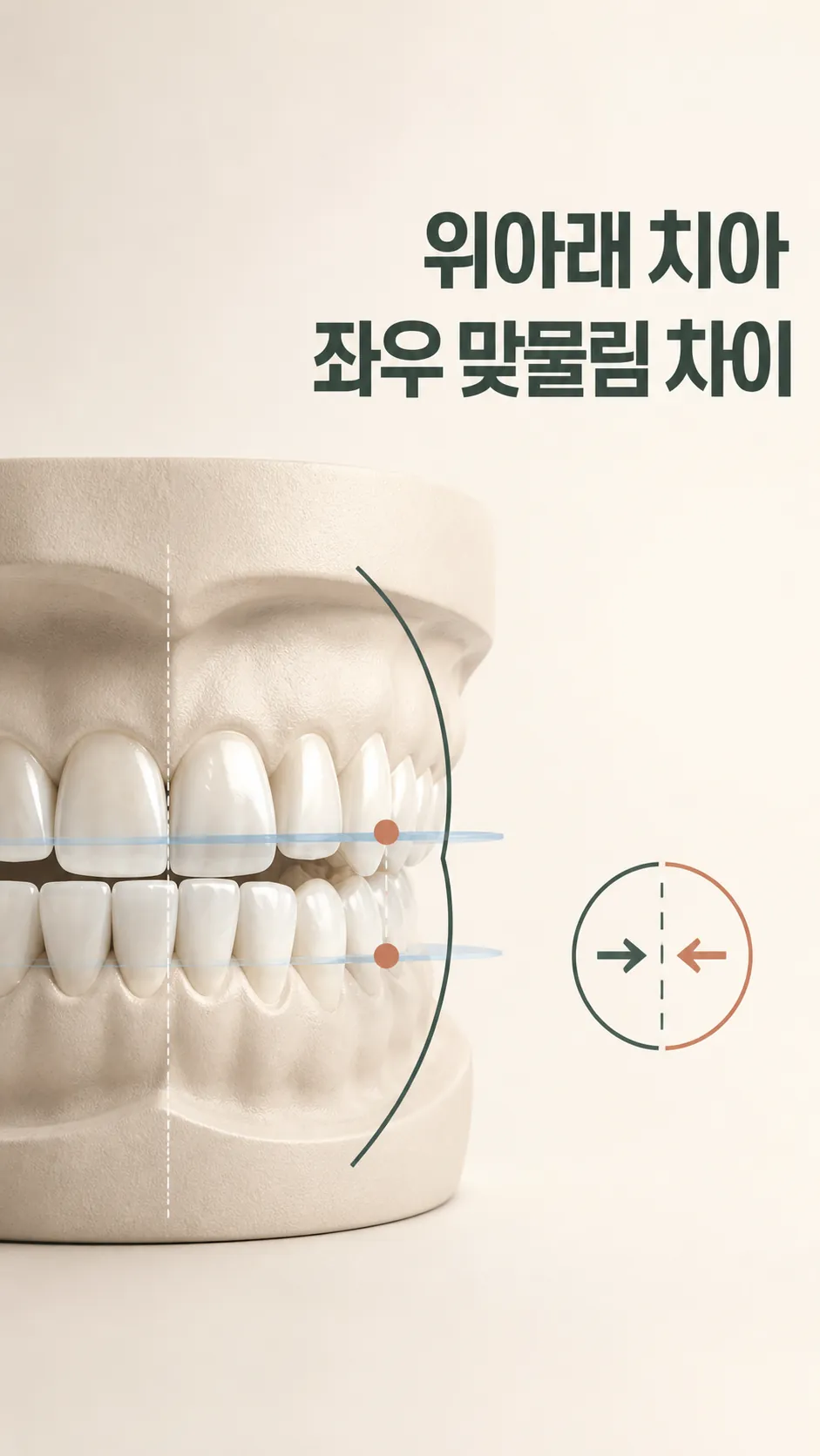 위아래 치아 좌우 맞물림 차이 단면 모식도
