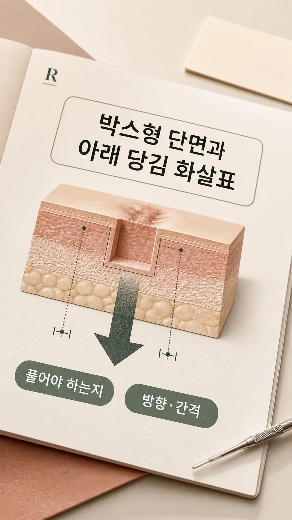 박스형 단면과 아래 당김 화살표