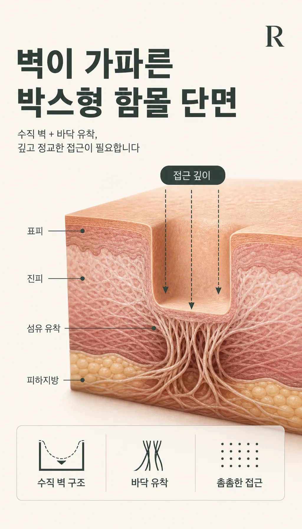 벽이 가파른 박스형 함몰 단면