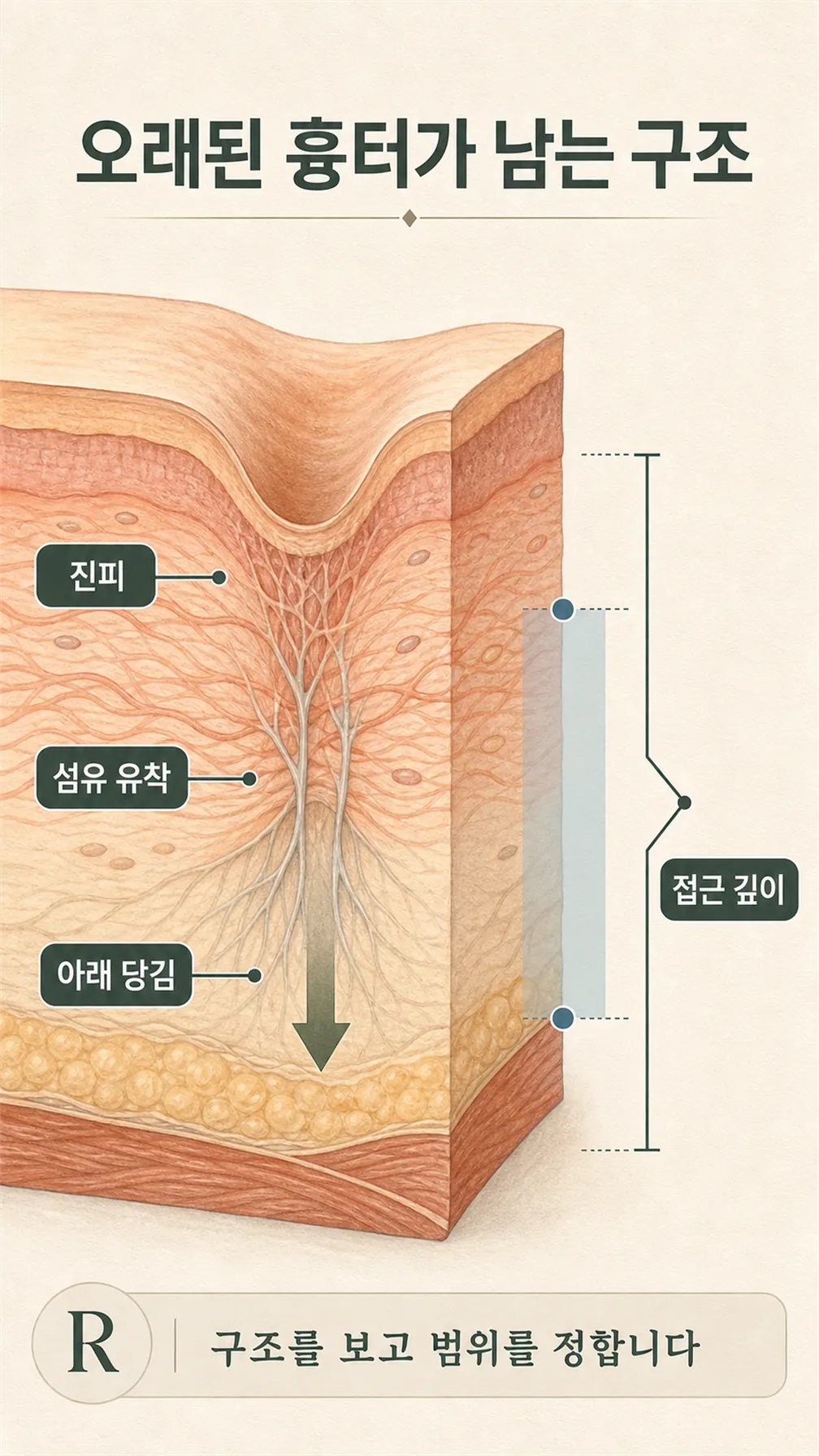 콜라겐 재배열 회복 흐름도
