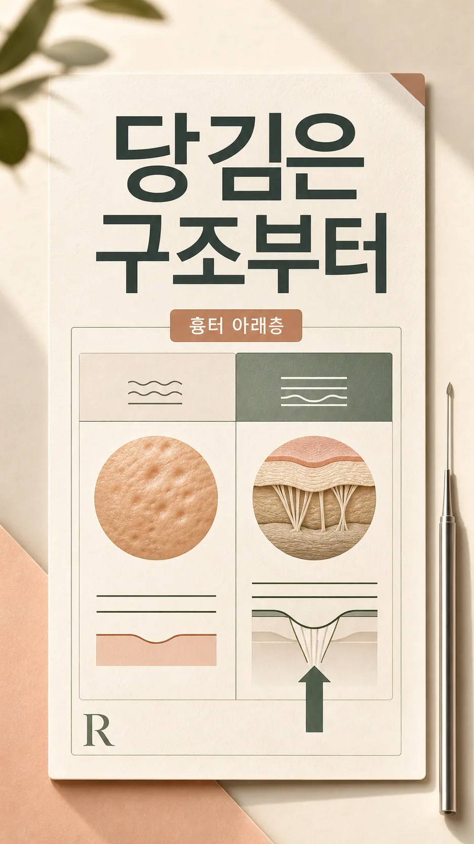 흉터 형태 세 가지 비교 그리드