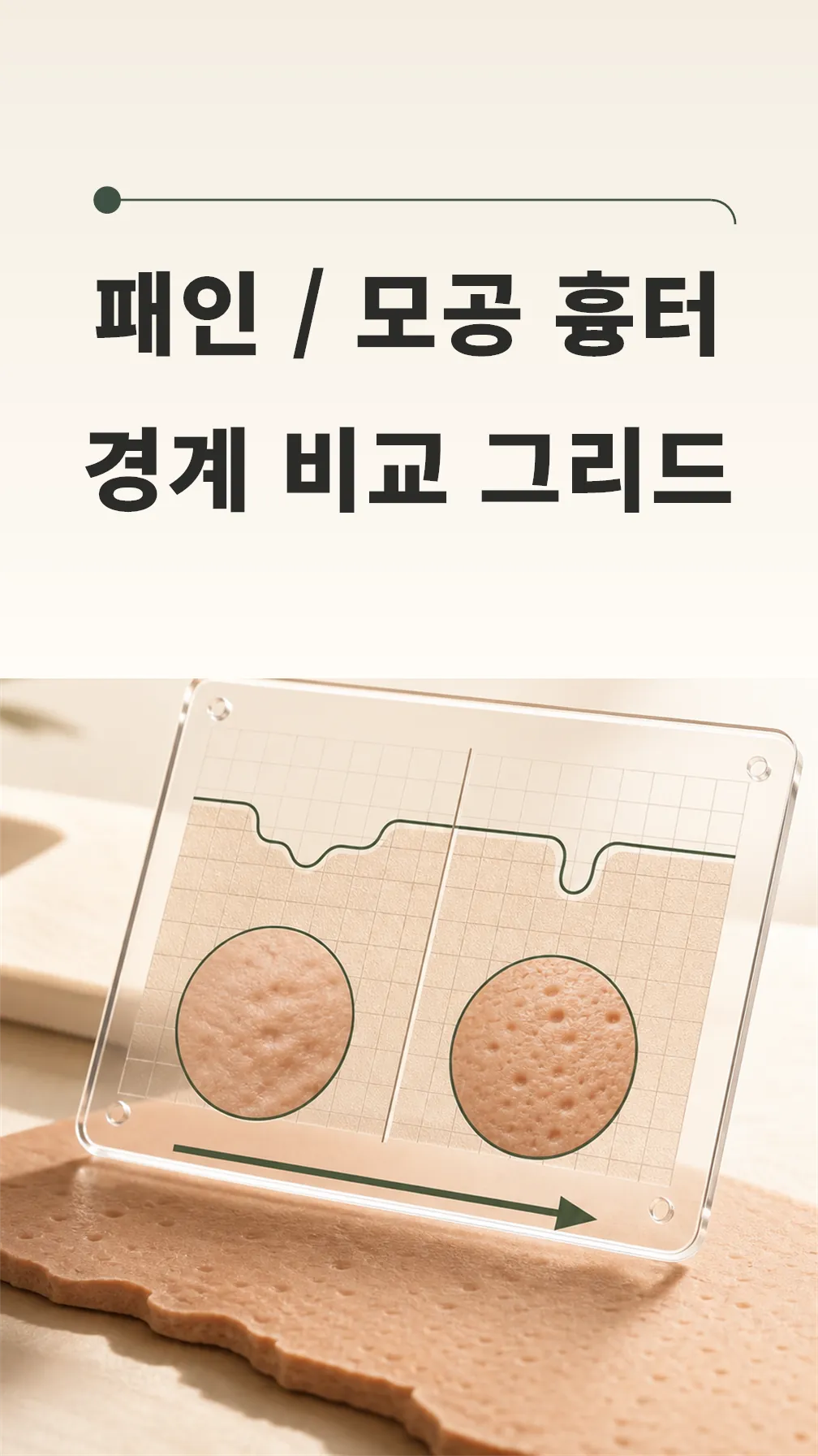 패인·모공 흉터 경계 비교 그리드