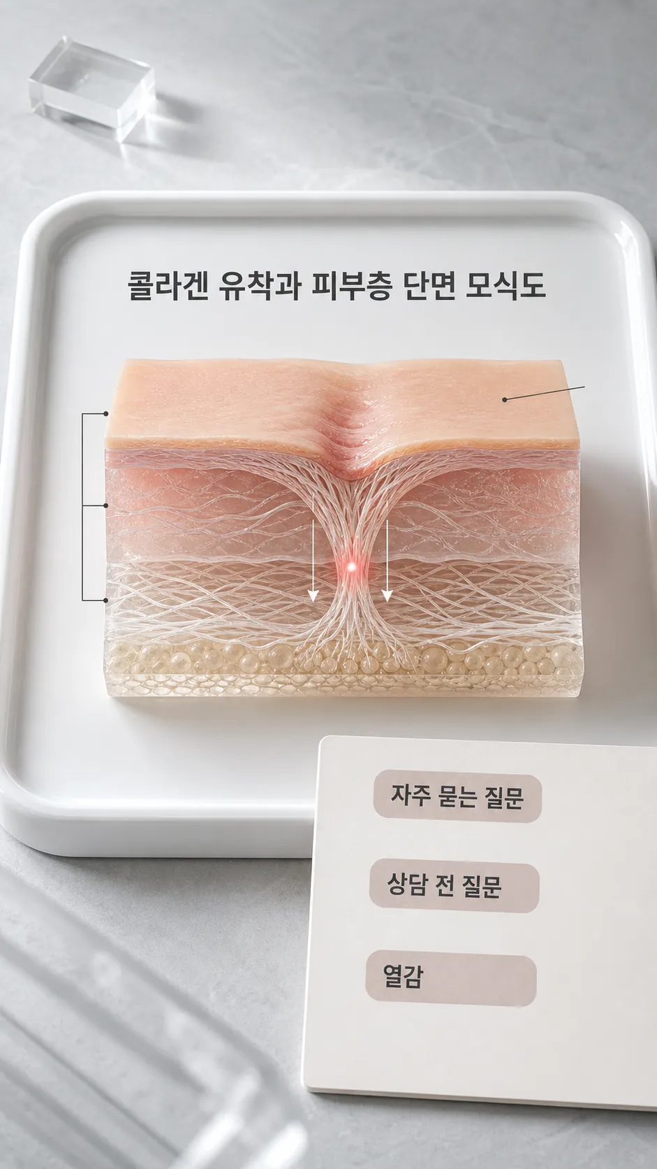 진피층 콜라겐 유착과 피부층 단면 모식도