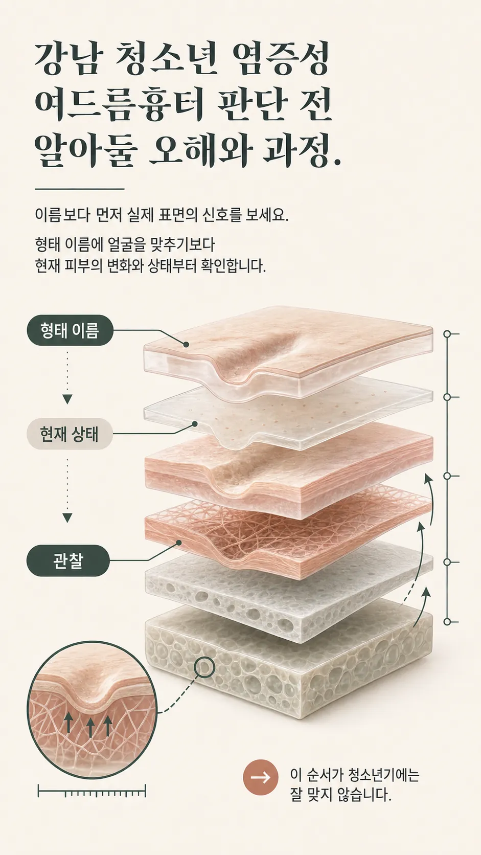 진피층 흉터 깊이와 회복 방향 단면 모식도