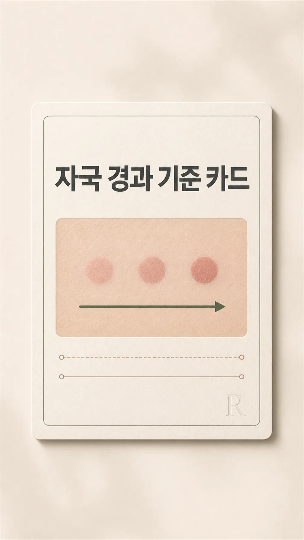자국 경과 기준 카드