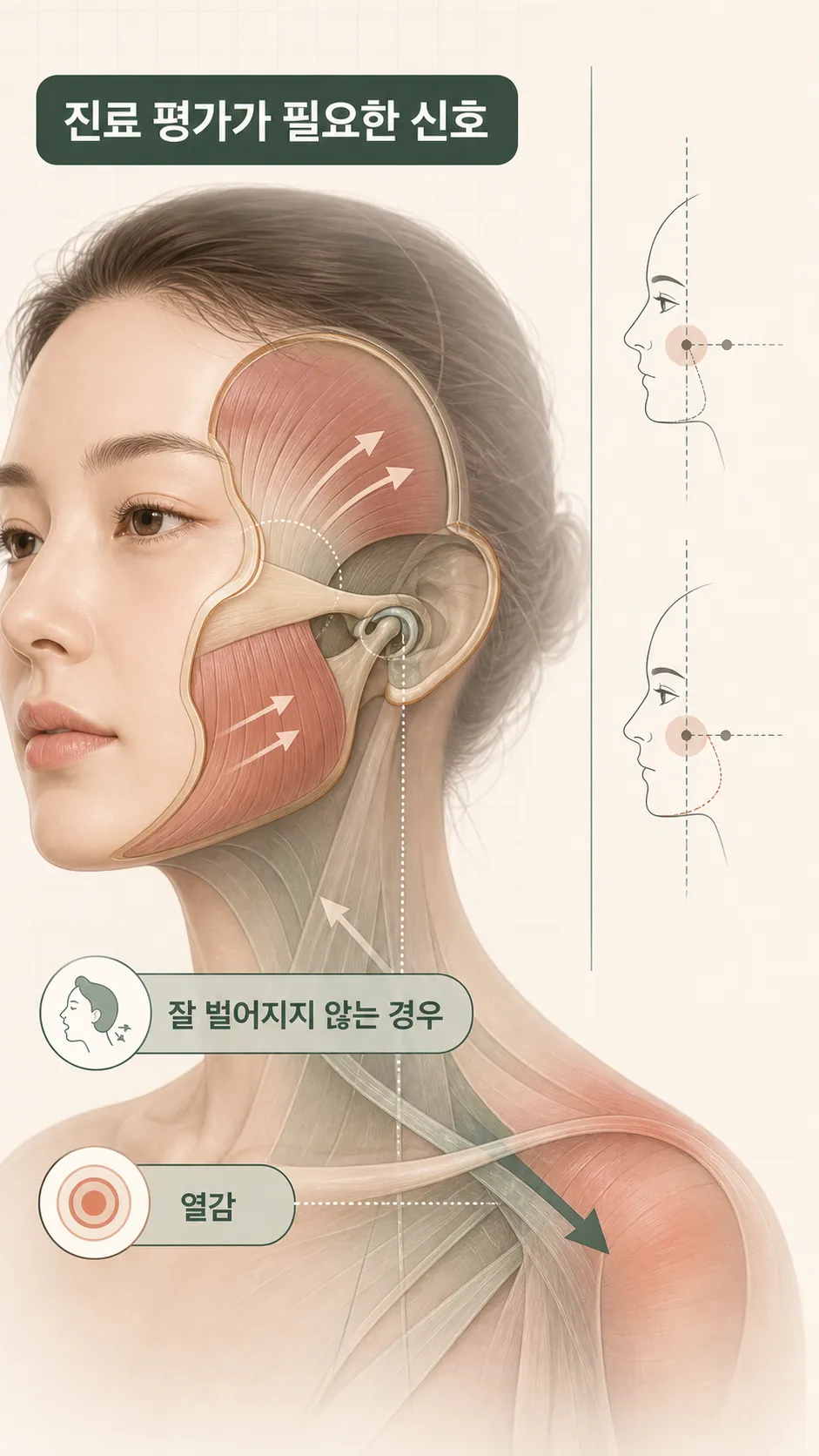 턱관절과 어깨선 긴장 관계 단면 모식도