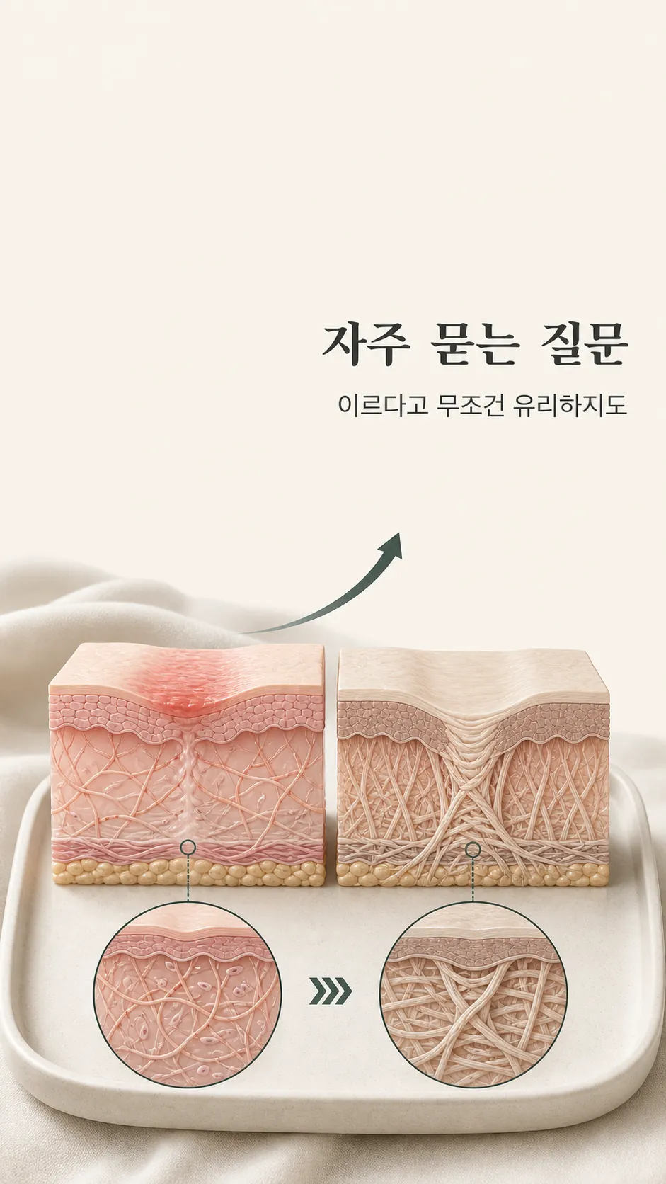 진피층 콜라겐 유착과 피부층 단면 모식도