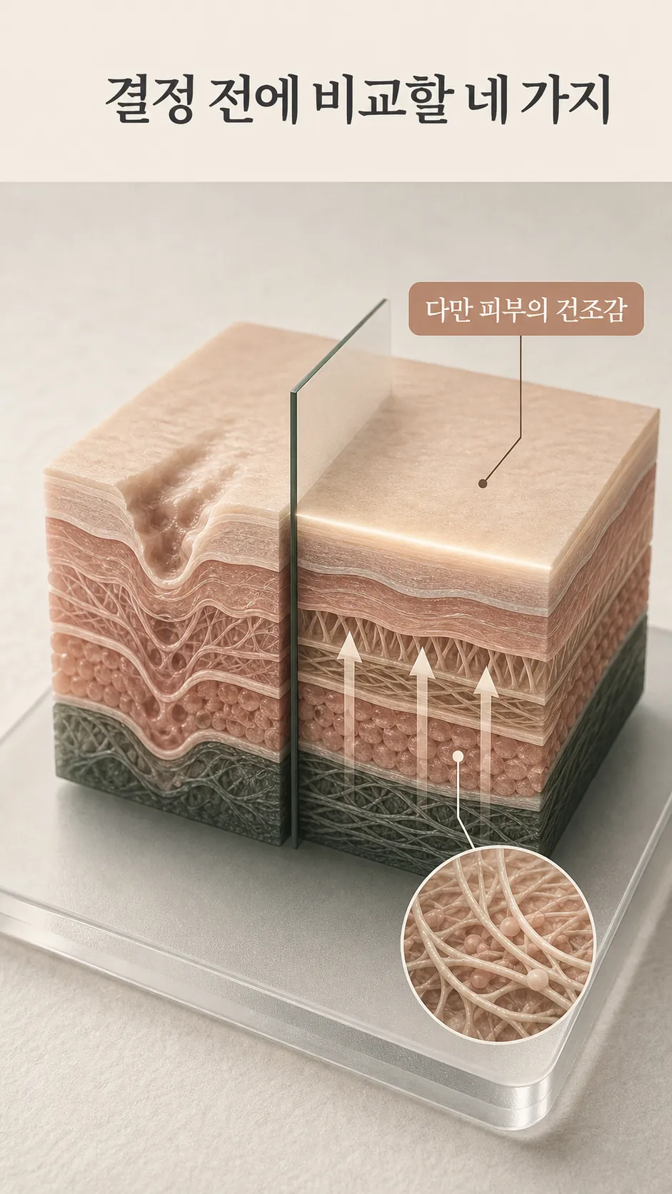 진피층 흉터 깊이와 회복 방향 단면 모식도