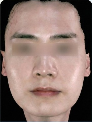 이전 의료기관 비대칭 기록 1 치료 후