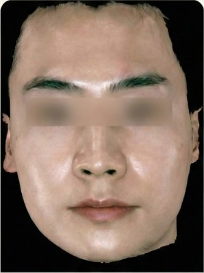 이전 의료기관 비대칭 기록 1 치료 전