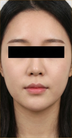 이전 의료기관 비대칭 기록 2 치료 후